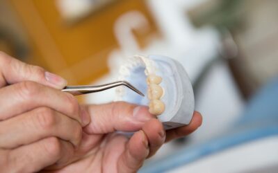 7 Frequently Asked Questions About Bridges